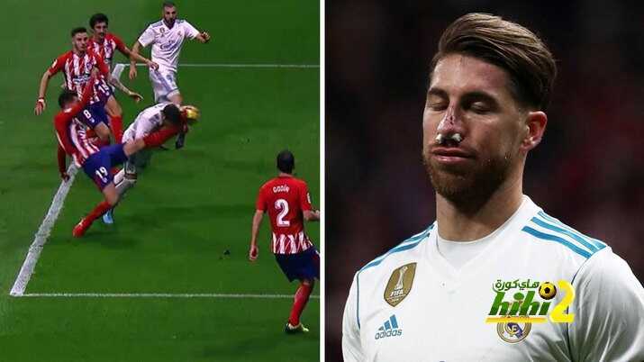 صورة : راموس تعرض لنفس الإصابة قبل عشر سنوات