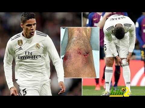 الكشف عن موقف فاران من الكلاسيكو
