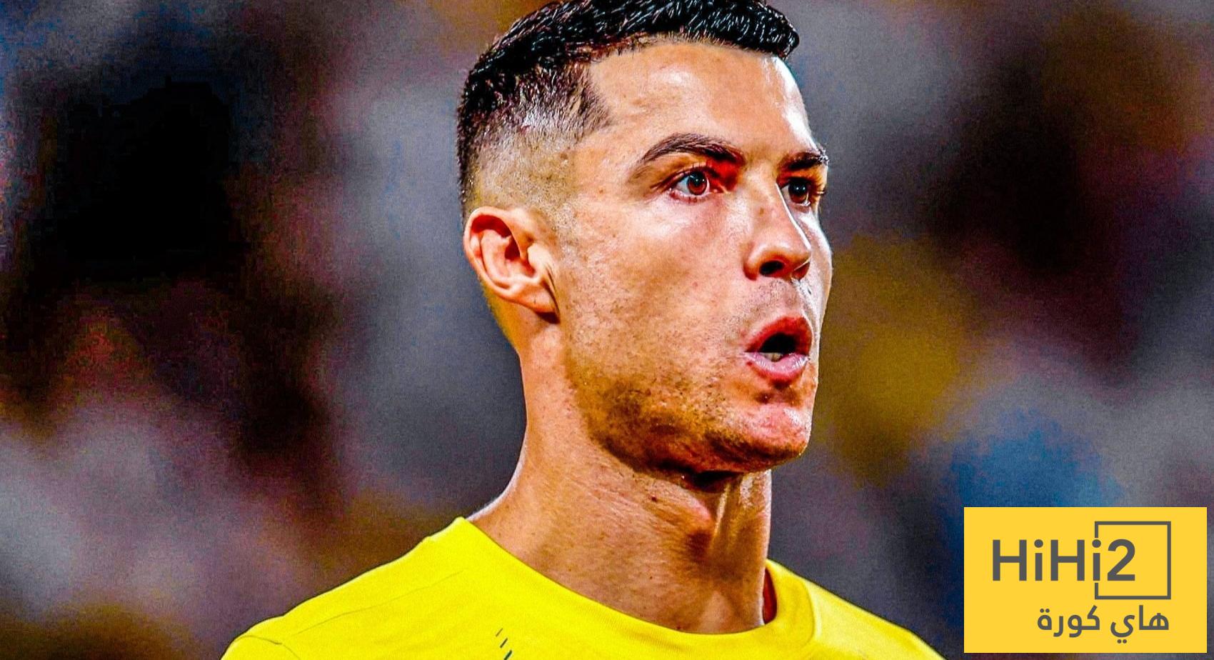 لا تمييز لـ رونالدو أو للنصر !